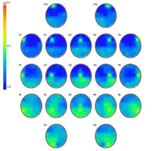 Brain Coordination Maps