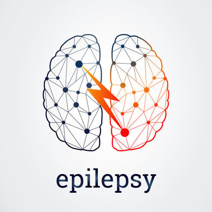 neurofeedback for epilepsy, epilepsy